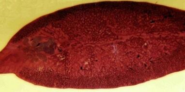 Παράσιτα Trematode, πώς να τα αφαιρέσετε από το σώμα