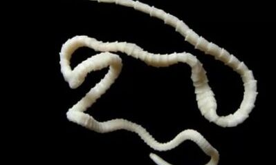 πώς να αφαιρέσετε το παράσιτο των κεστωδών από το σώμα